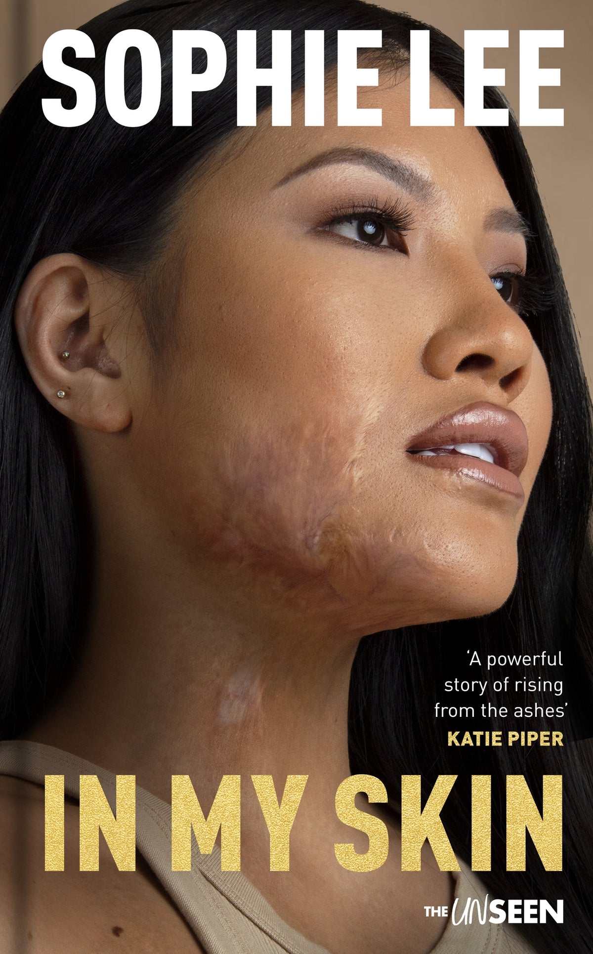 Cover image for In My Skin ISBN 9780281089413