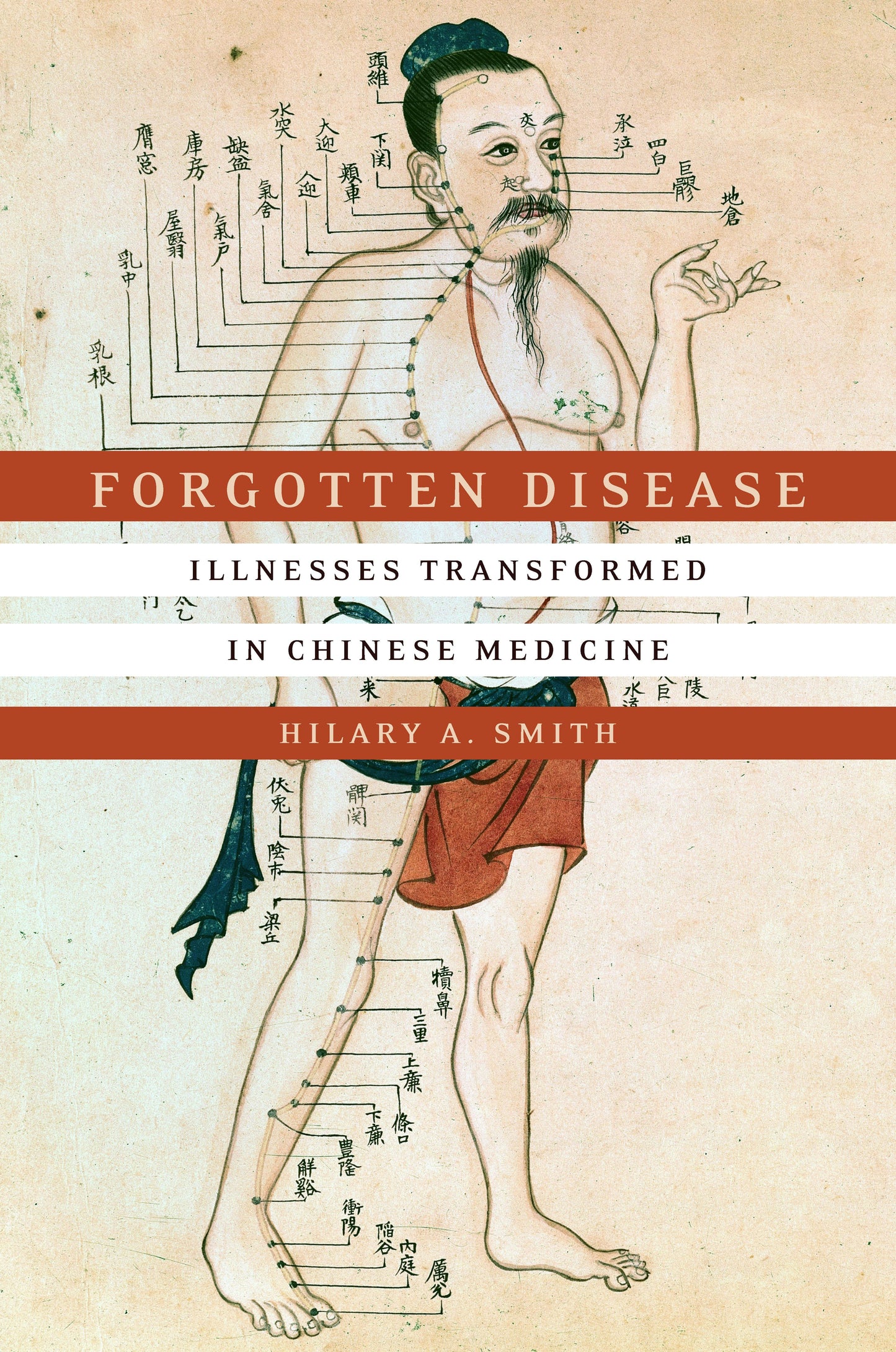 Book cover image for Forgotten Disease ISBN: 9781503602090