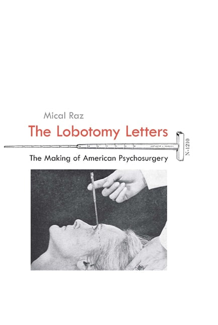 Book cover image for The Lobotomy Letters ISBN: 9781580465243
