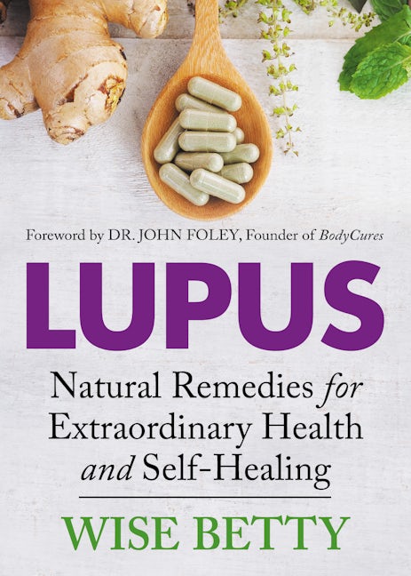 Book cover image for Lupus ISBN: 9781642793932