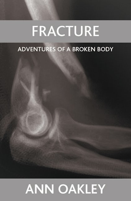 Book cover image for Fracture ISBN: 9781861349378