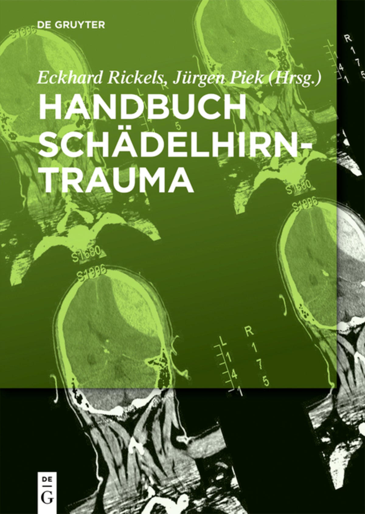 Cover image for Handbuch Schädelhirntrauma ISBN 9783110372342
