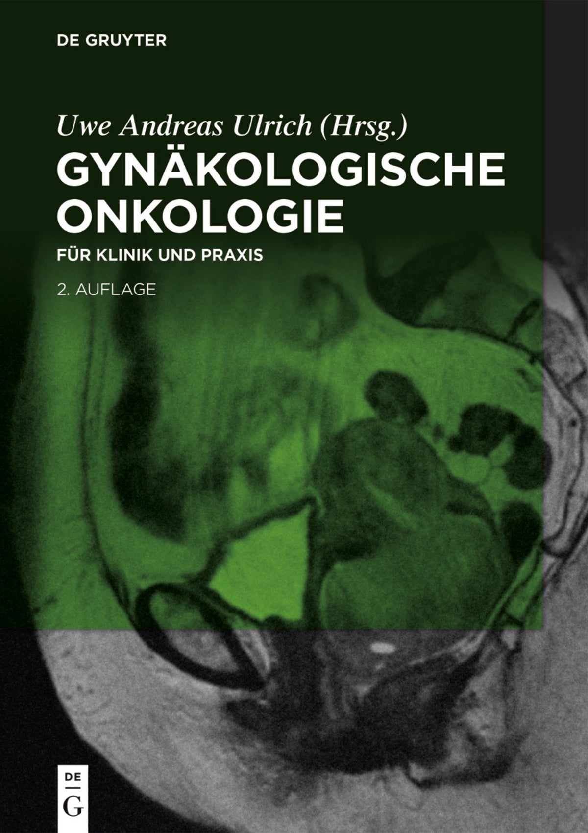 Cover image for Gynäkologische Onkologie ISBN 9783110612615