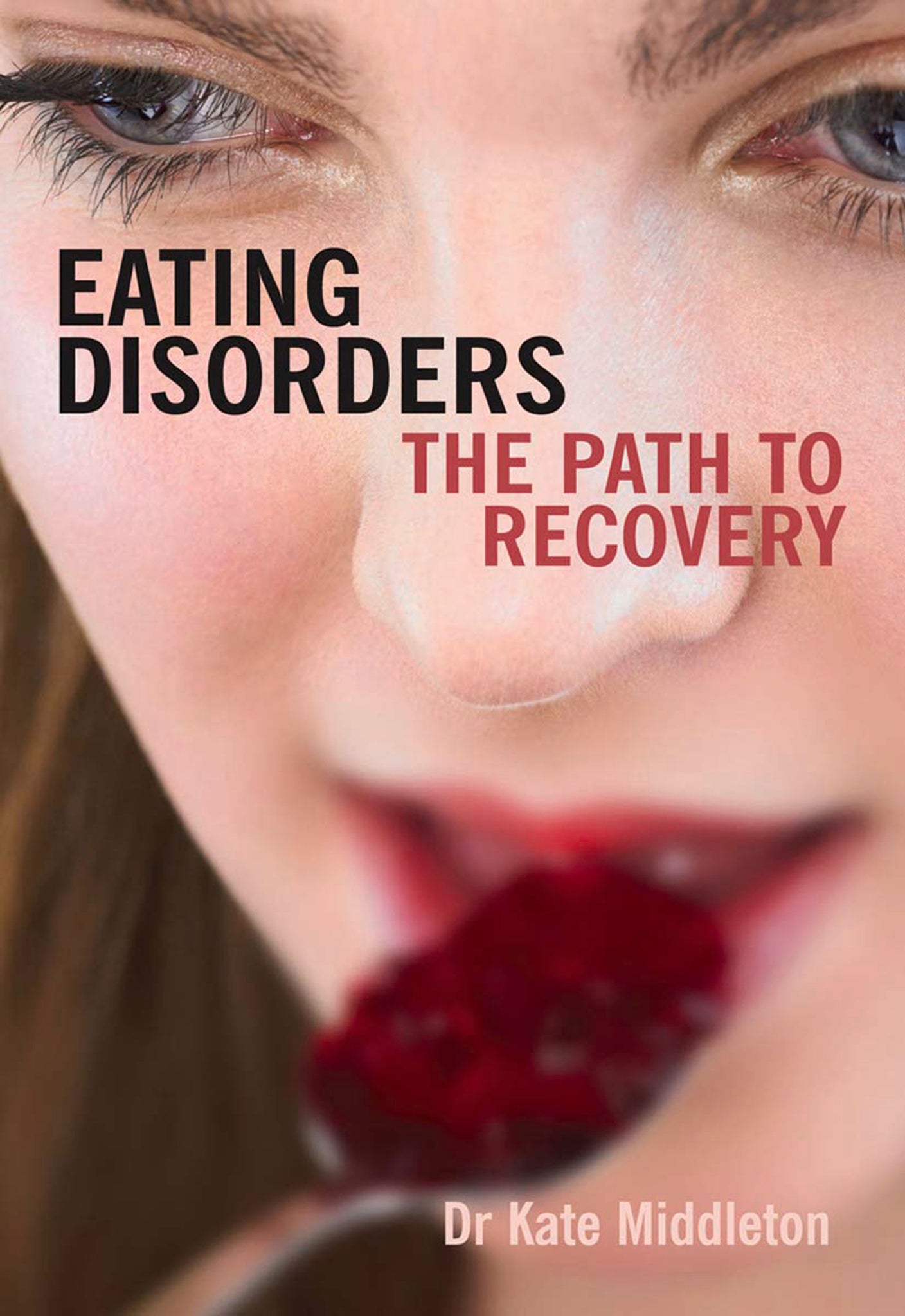 Eating Disorders