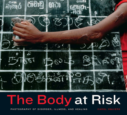 The Body at Risk
