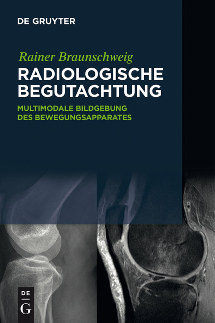 Cover image for Radiologische Begutachtung ISBN 9783110517934