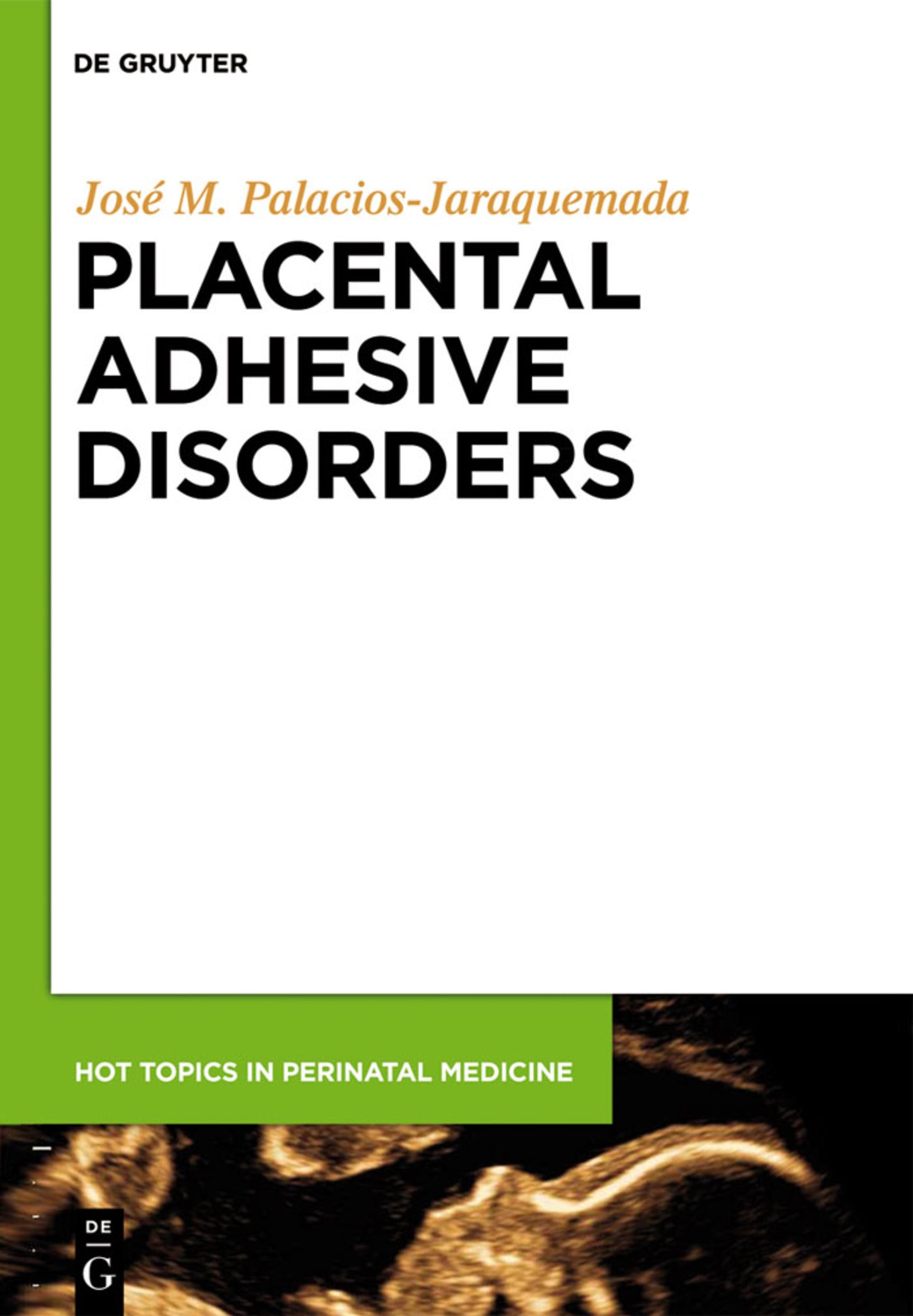 Cover image for Placental Adhesive Disorders ISBN 9783110282306