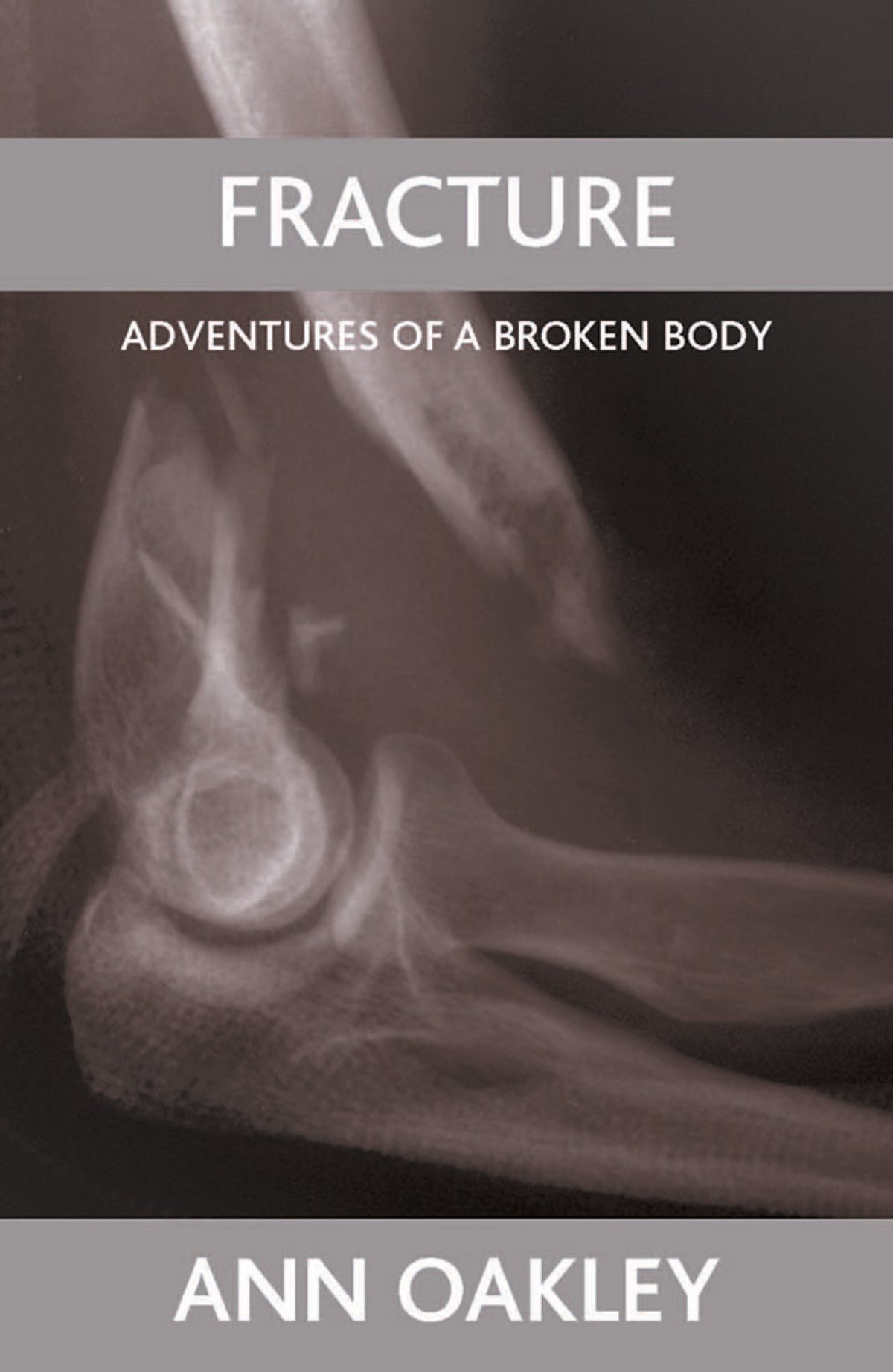 Cover image for Fracture ISBN 9781861349378