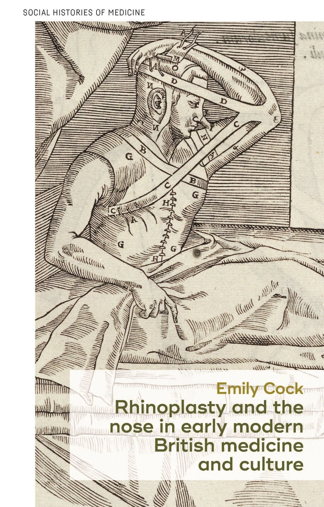 Cover image for Rhinoplasty and the nose in early modern British medicine and culture ISBN 9781526160744