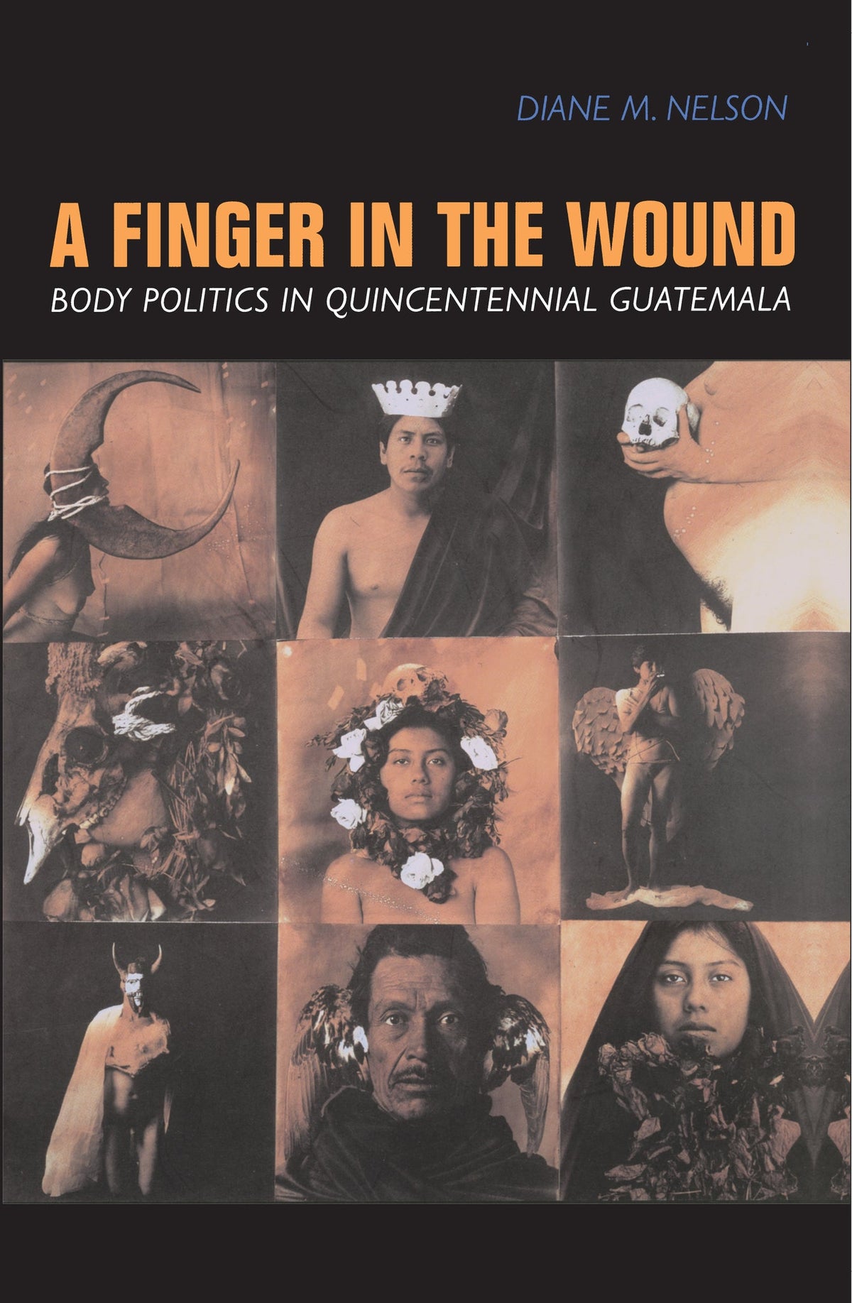 Cover image for A Finger in the Wound ISBN 9780520920606