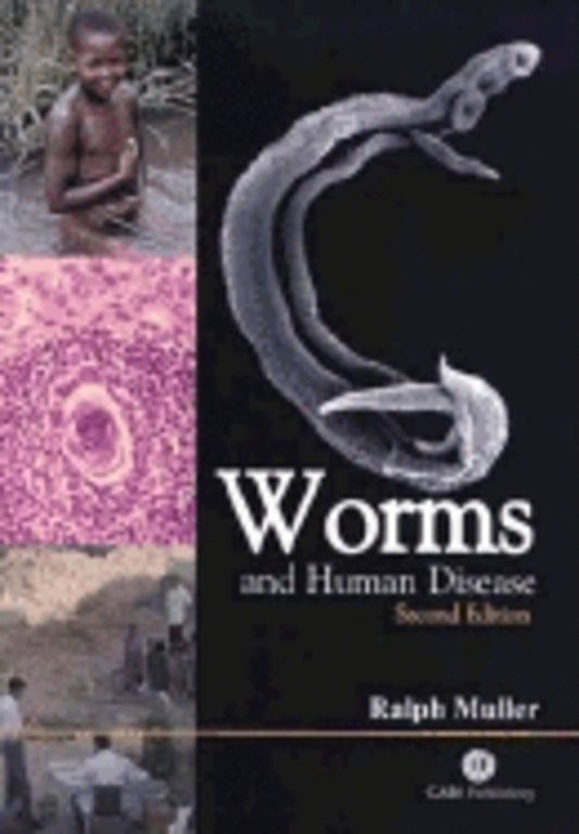Worms and Human Disease