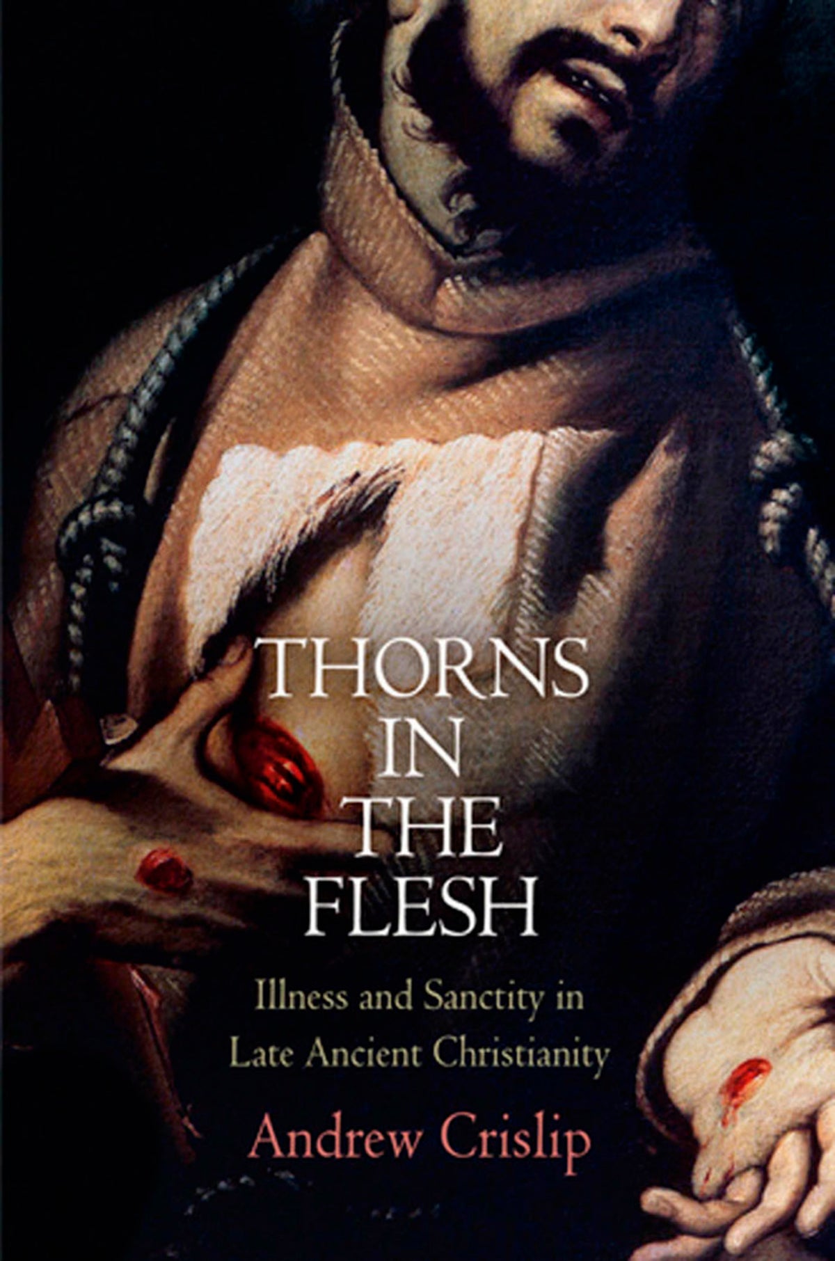 Thorns in the Flesh