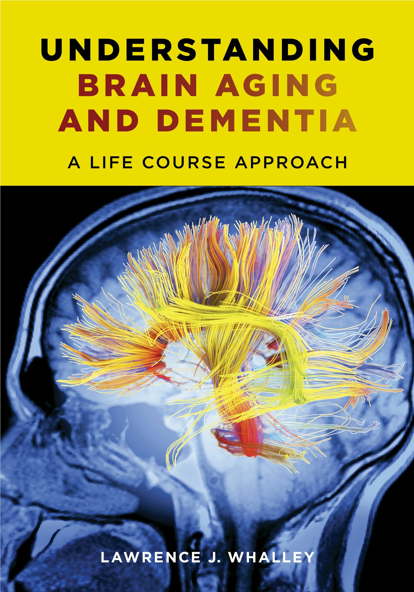 Book cover image for Understanding Brain Aging and Dementia ISBN: 9780231163835