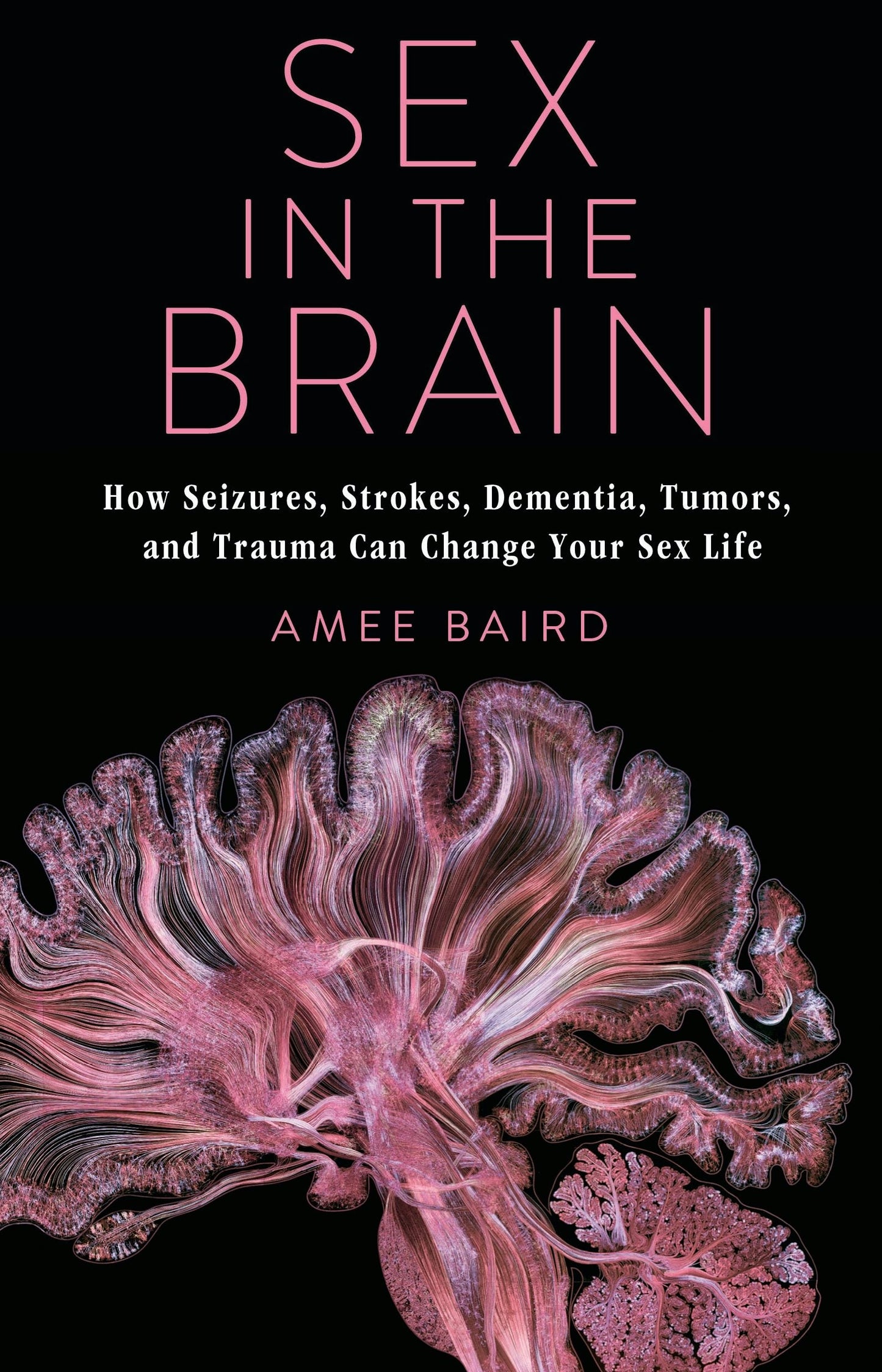 Book cover image for Sex in the Brain ISBN: 9780231195904