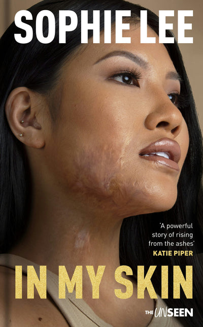 Cover image for In My Skin, isbn: 9780281089406