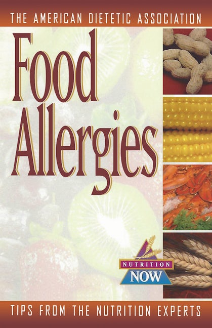 Book cover image for Food Allergies ISBN: 9780471347149
