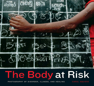 Cover image for The Body at Risk, isbn: 9780520932760