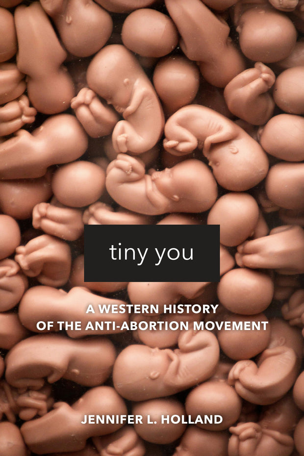 Cover image for Tiny You, isbn: 9780520968479