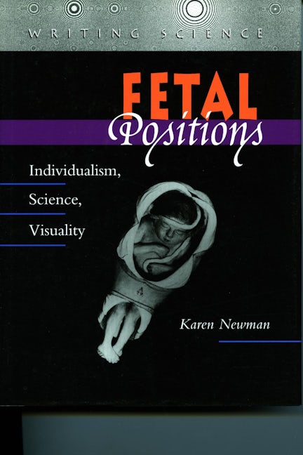 Book cover image for Fetal Positions ISBN: 9780804726474