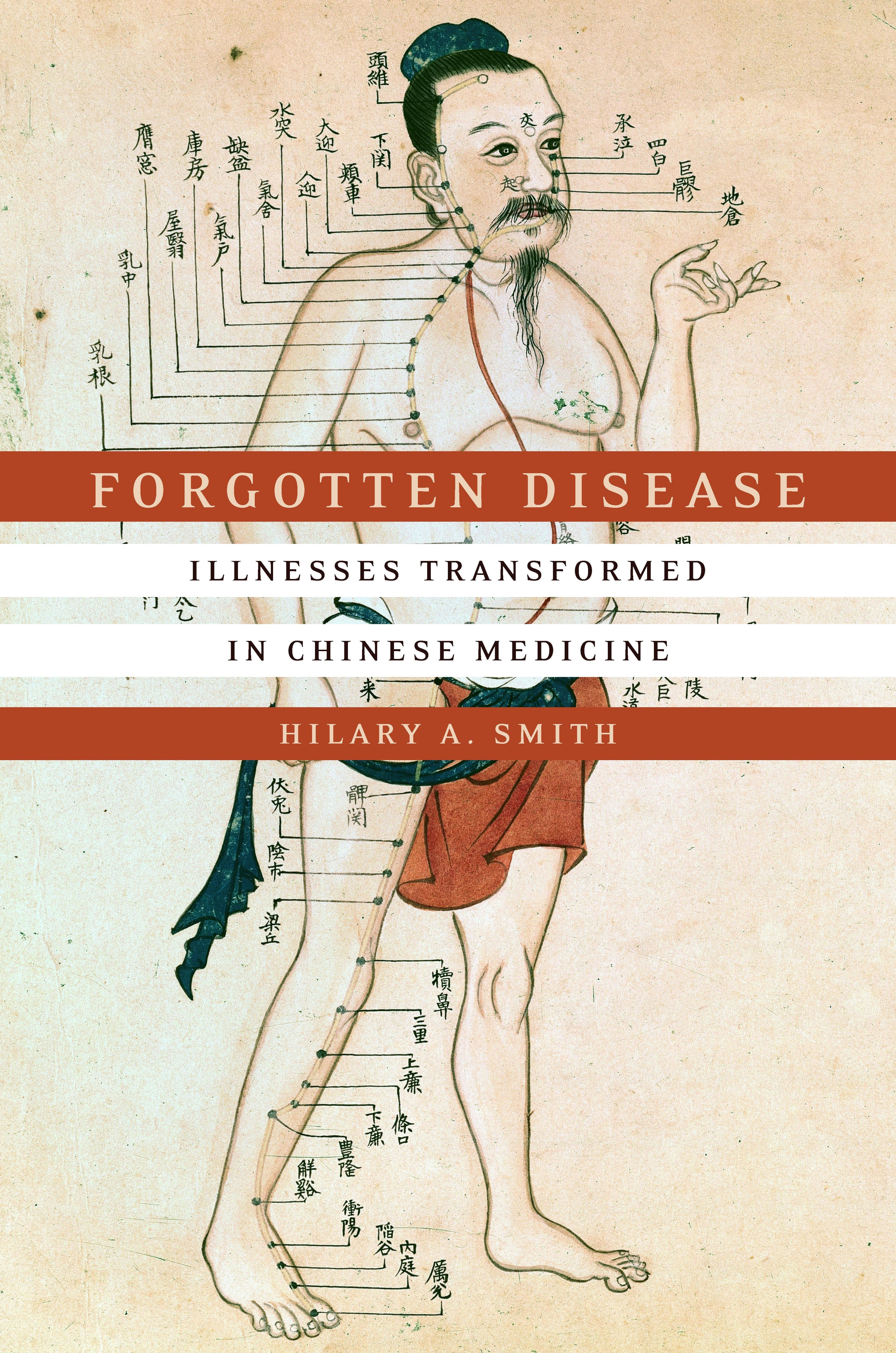 Book cover image for Forgotten Disease ISBN: 9781503602090