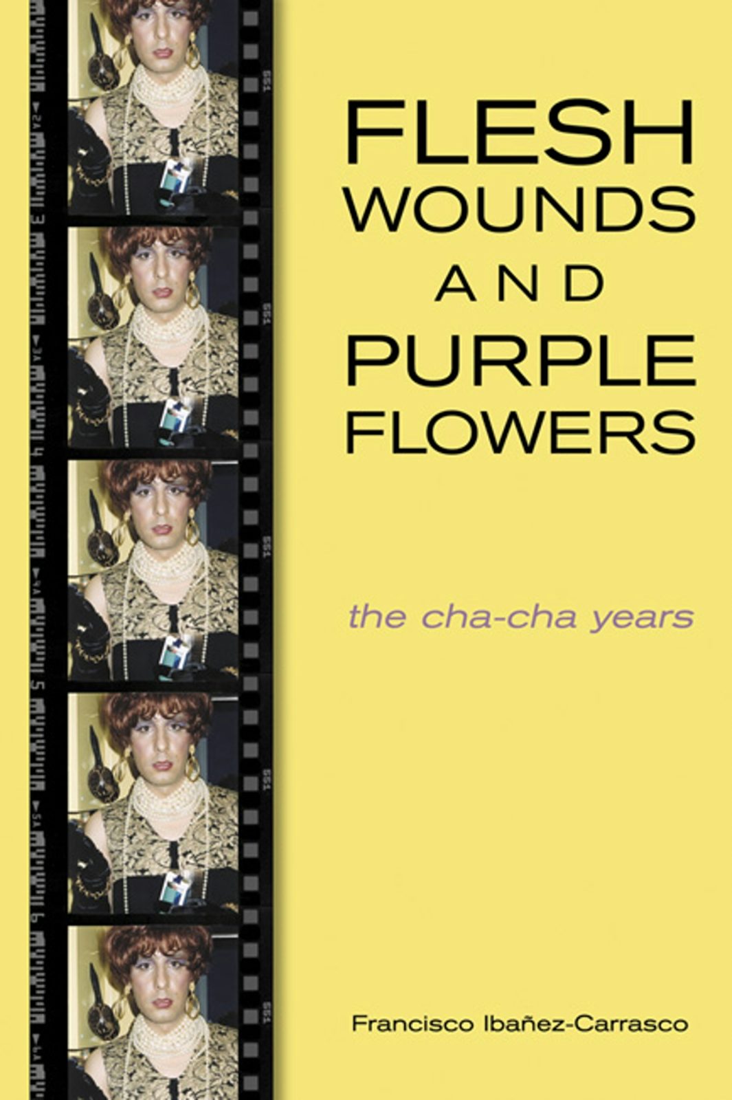 Book cover image for Flesh Wounds and Purple Flowers ISBN: 9781551520988