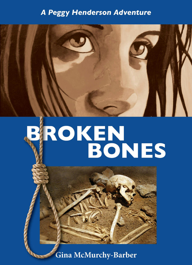 Cover image for Broken Bones, isbn: 9781554888610