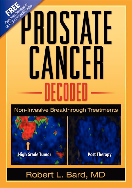 Book cover image for Prostate Cancer Decoded ISBN: 9781600373466
