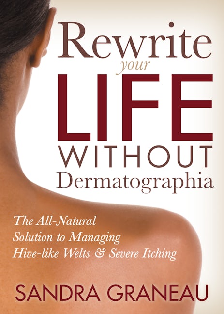 Book cover image for Rewrite Your Life Without Dermatographia ISBN: 9781642794755