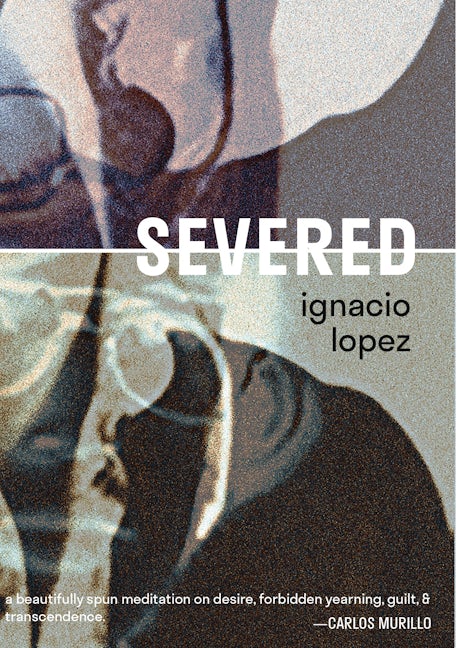 Book cover image for Severed ISBN: 9781732545229