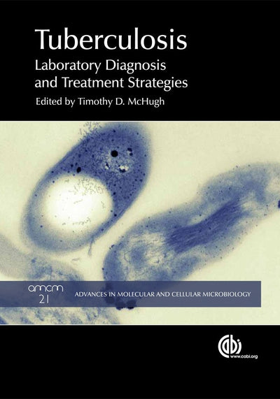 Cover image for Tuberculosis, isbn: 9781845938079