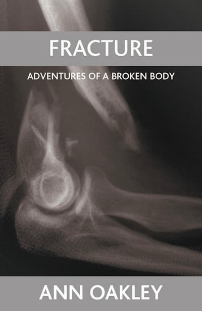 Fracture
