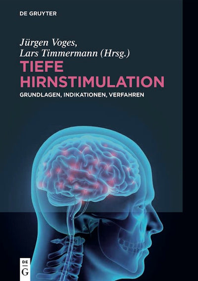 Tiefe Hirnstimulation