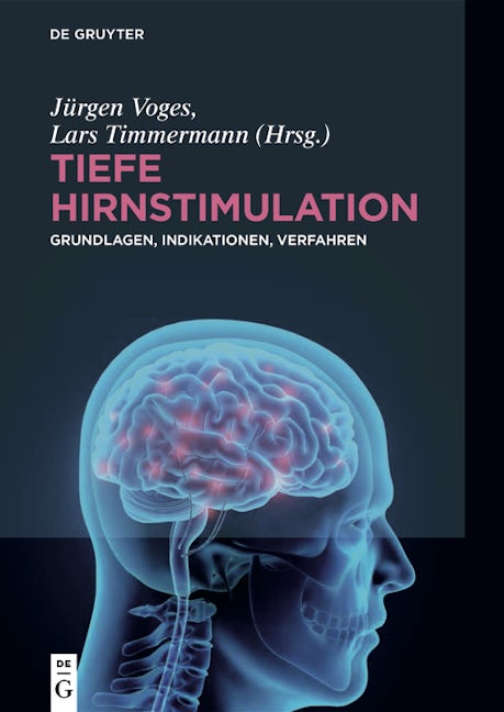 Tiefe Hirnstimulation