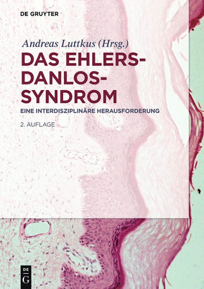 Das Ehlers-Danlos-Syndrom