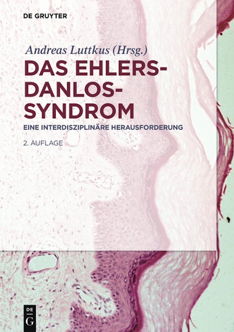 Das Ehlers-Danlos-Syndrom