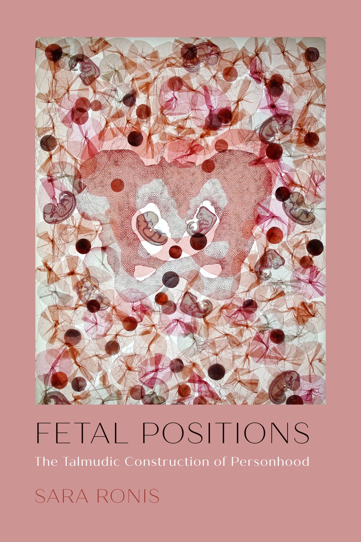 Fetal Positions