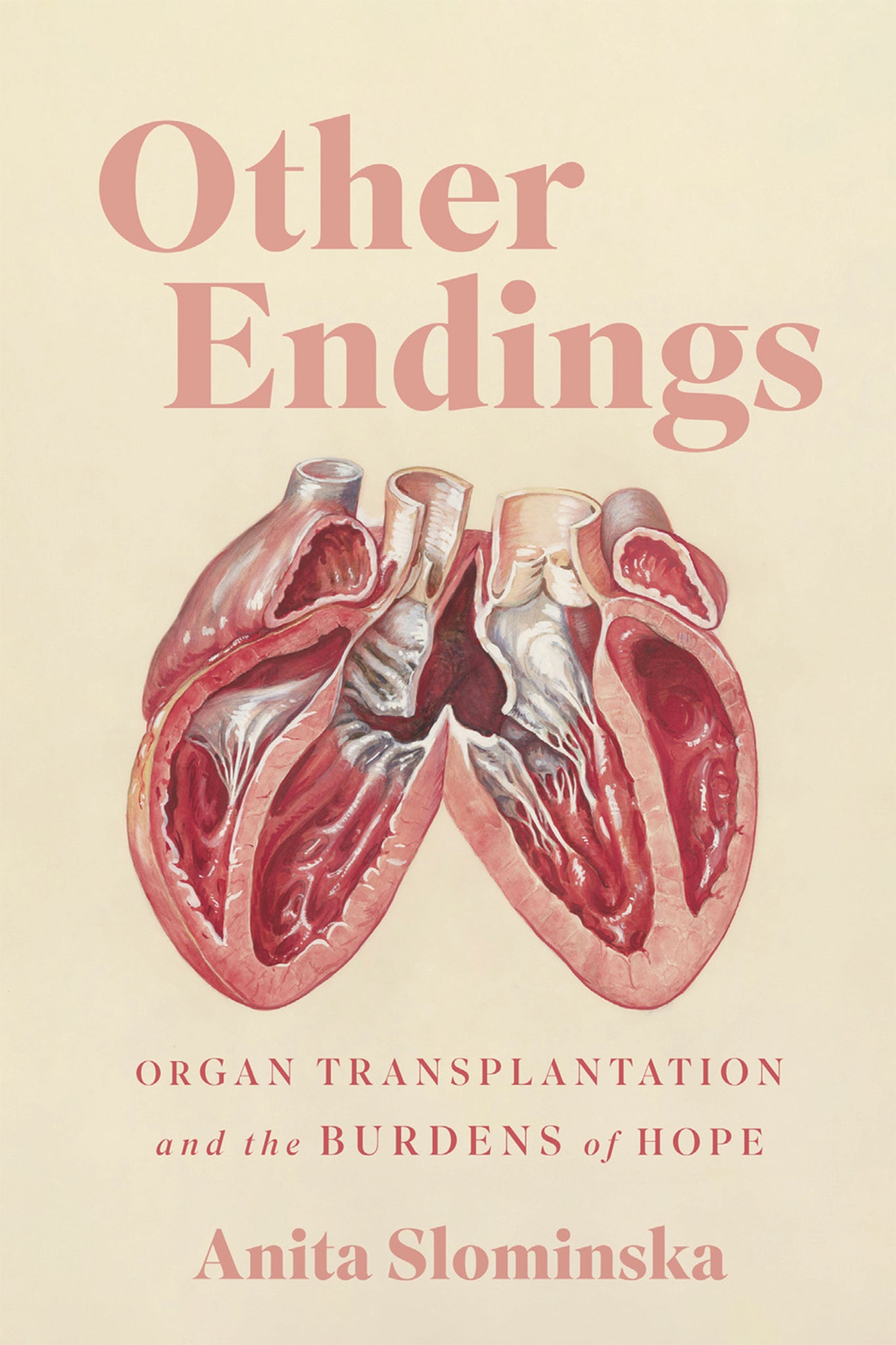 Other Endings