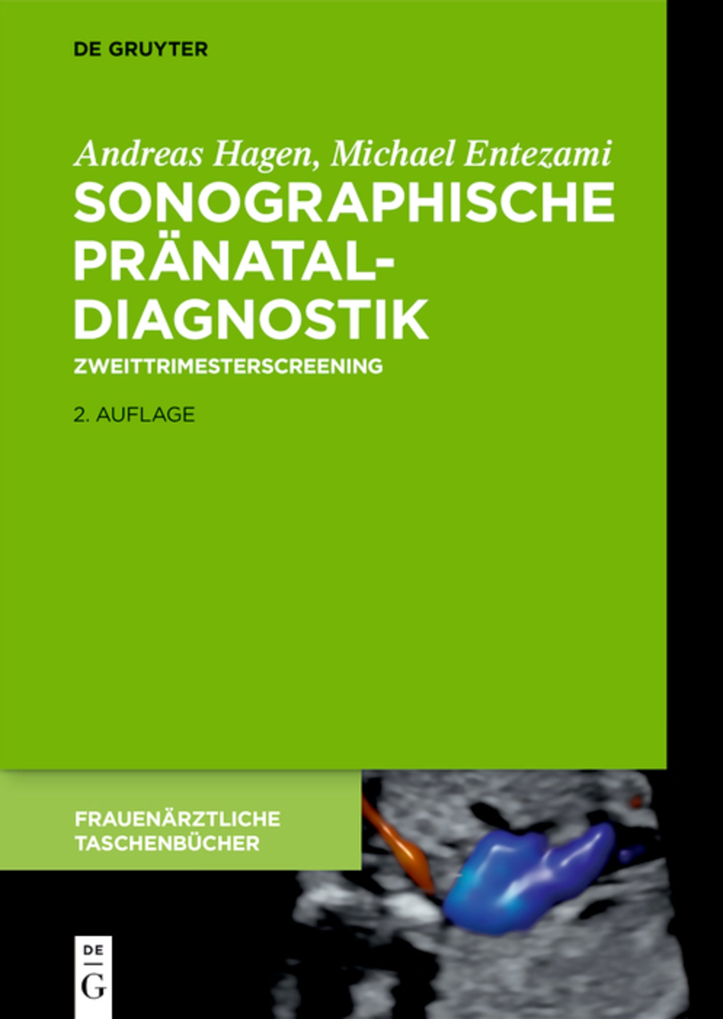 Cover image for Sonographische Pränataldiagnostik ISBN 9783110647129