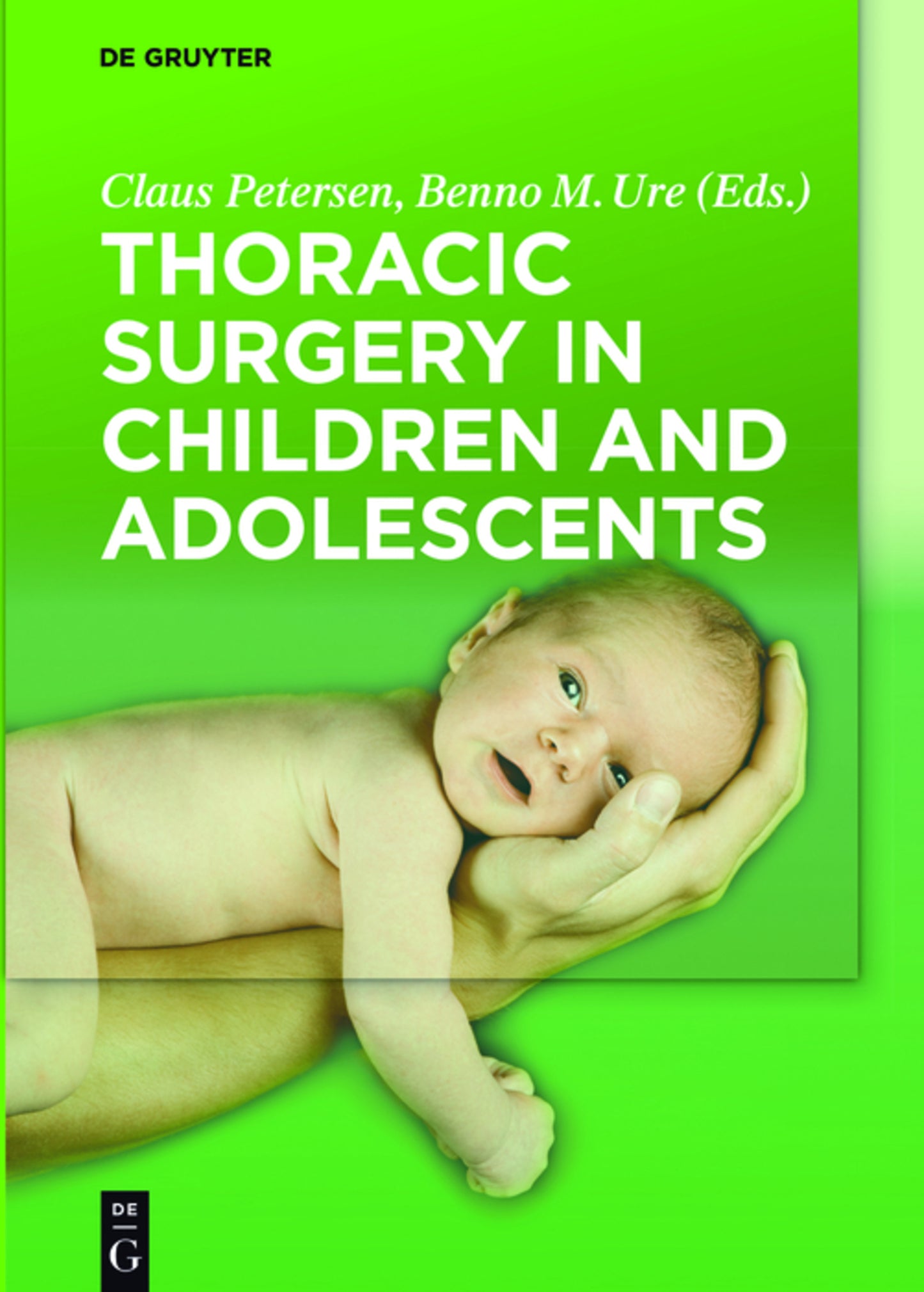 Thoracic Surgery in Children and Adolescents