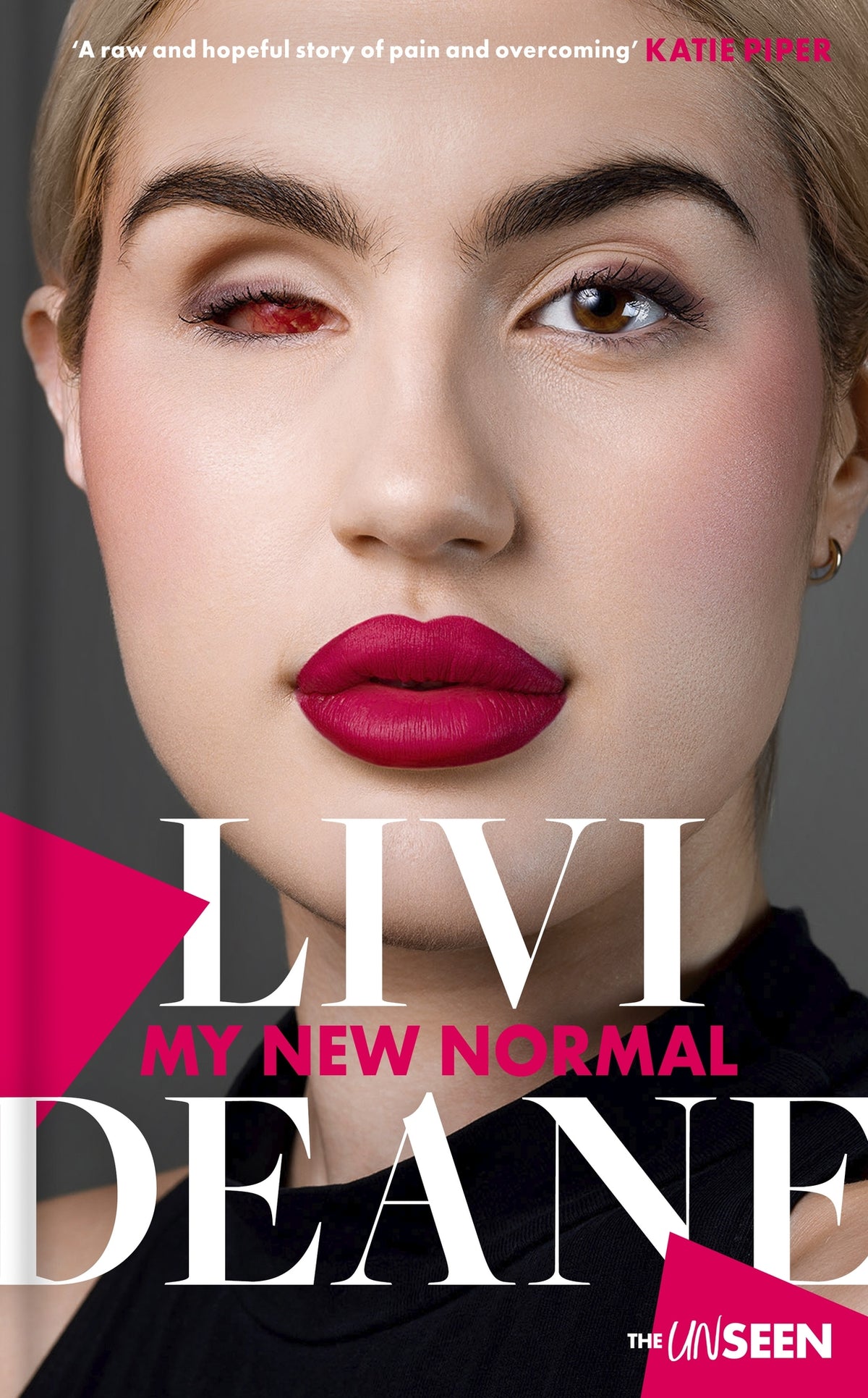 Cover image for My New Normal ISBN 9780281088096