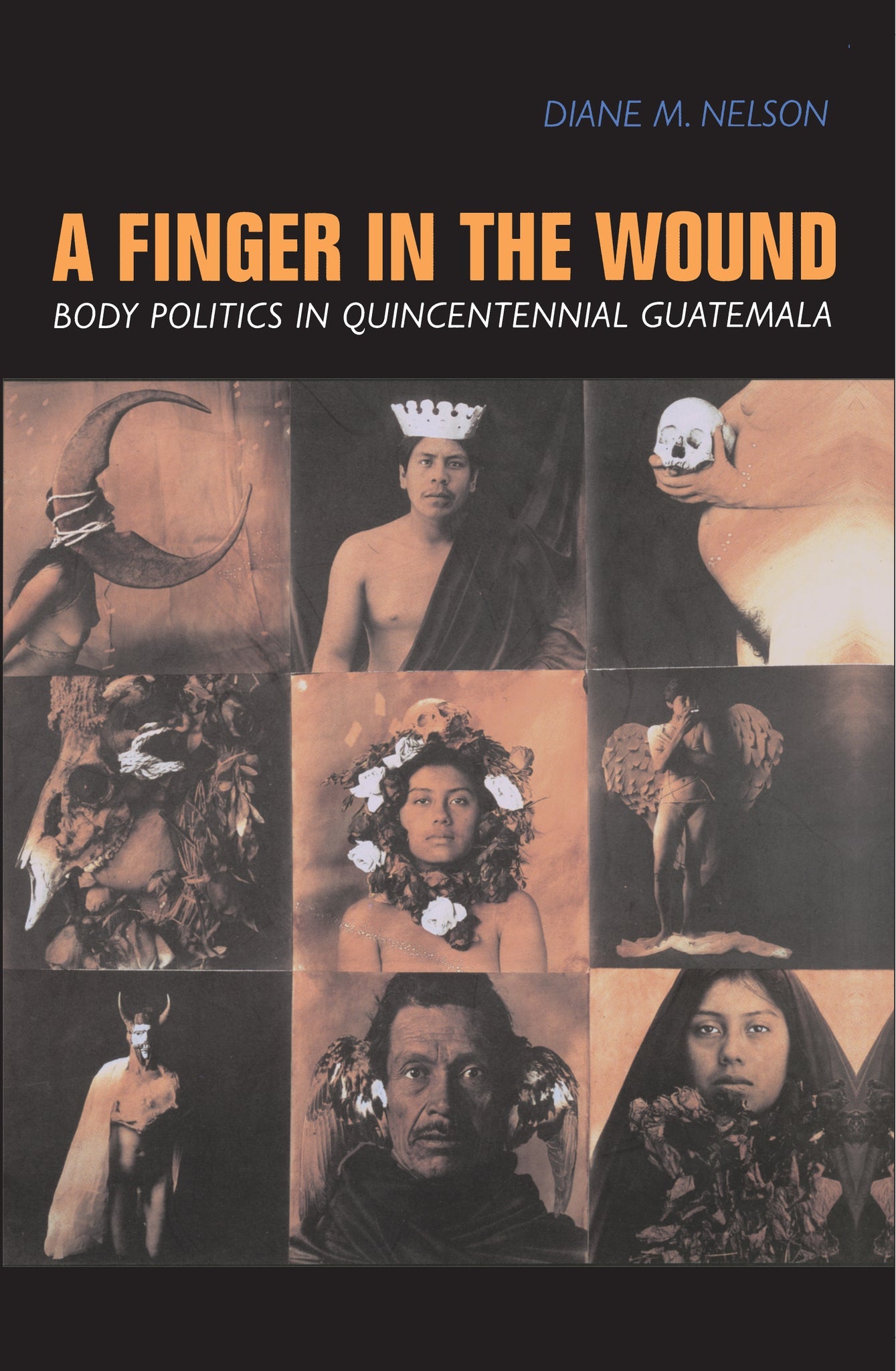 Cover image for A Finger in the Wound ISBN 9780520920606