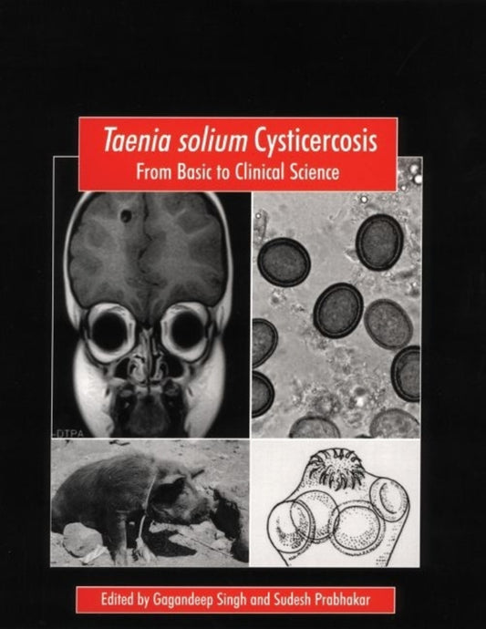 Taenia solium Cysticercosis: From Basic to Clinical Science