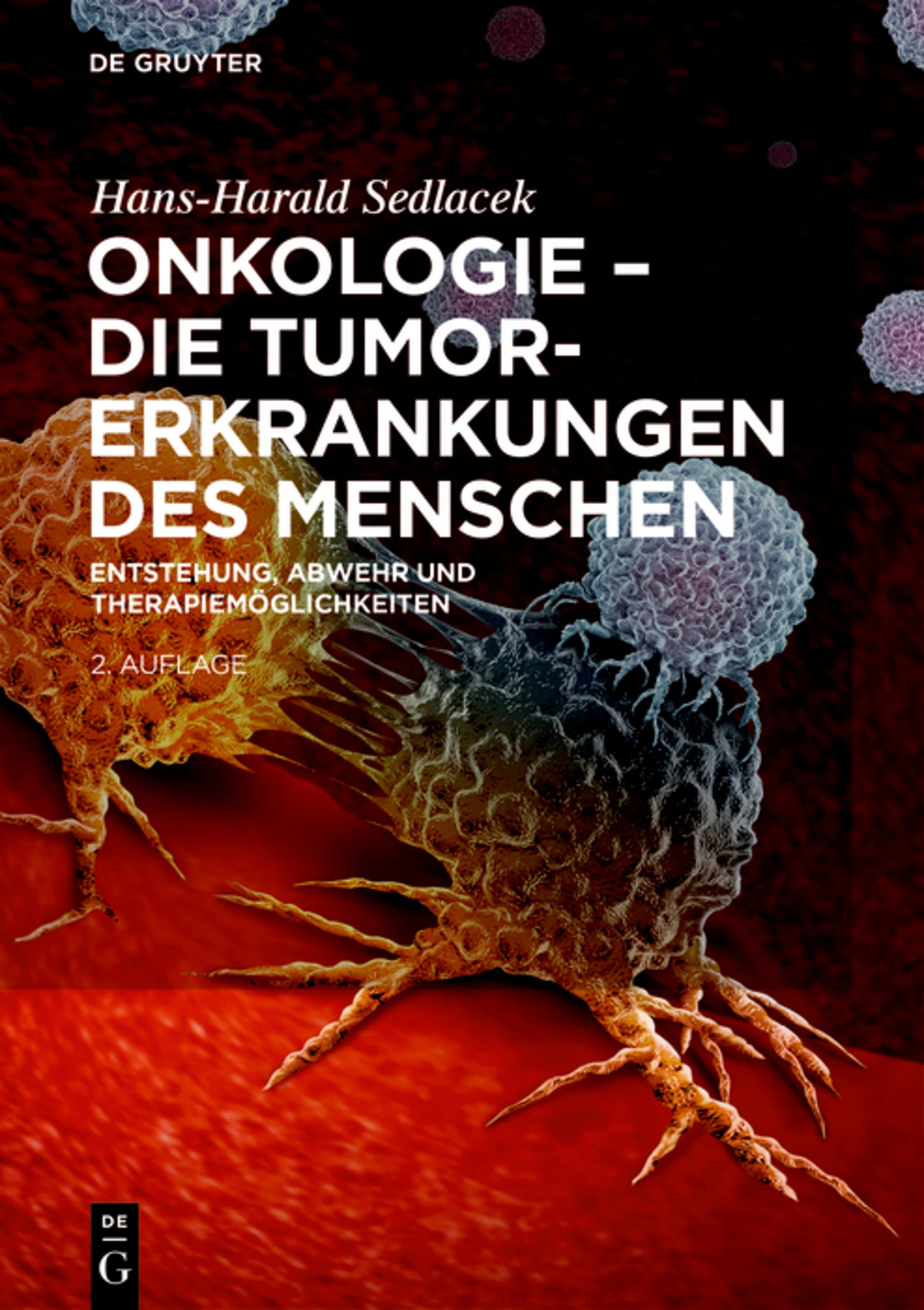 Onkologie - Die Tumorerkrankungen des Menschen