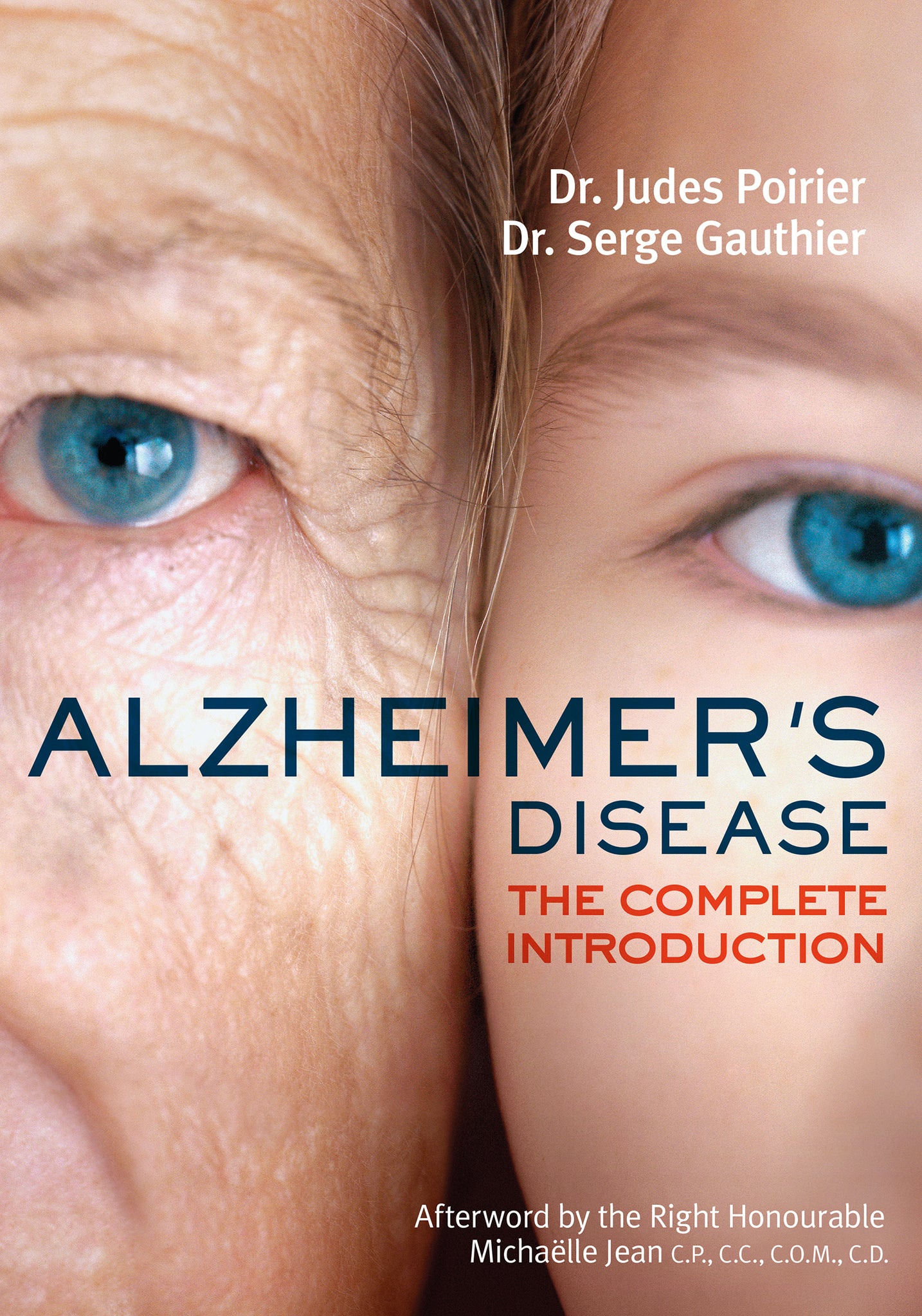 Alzheimer's Disease