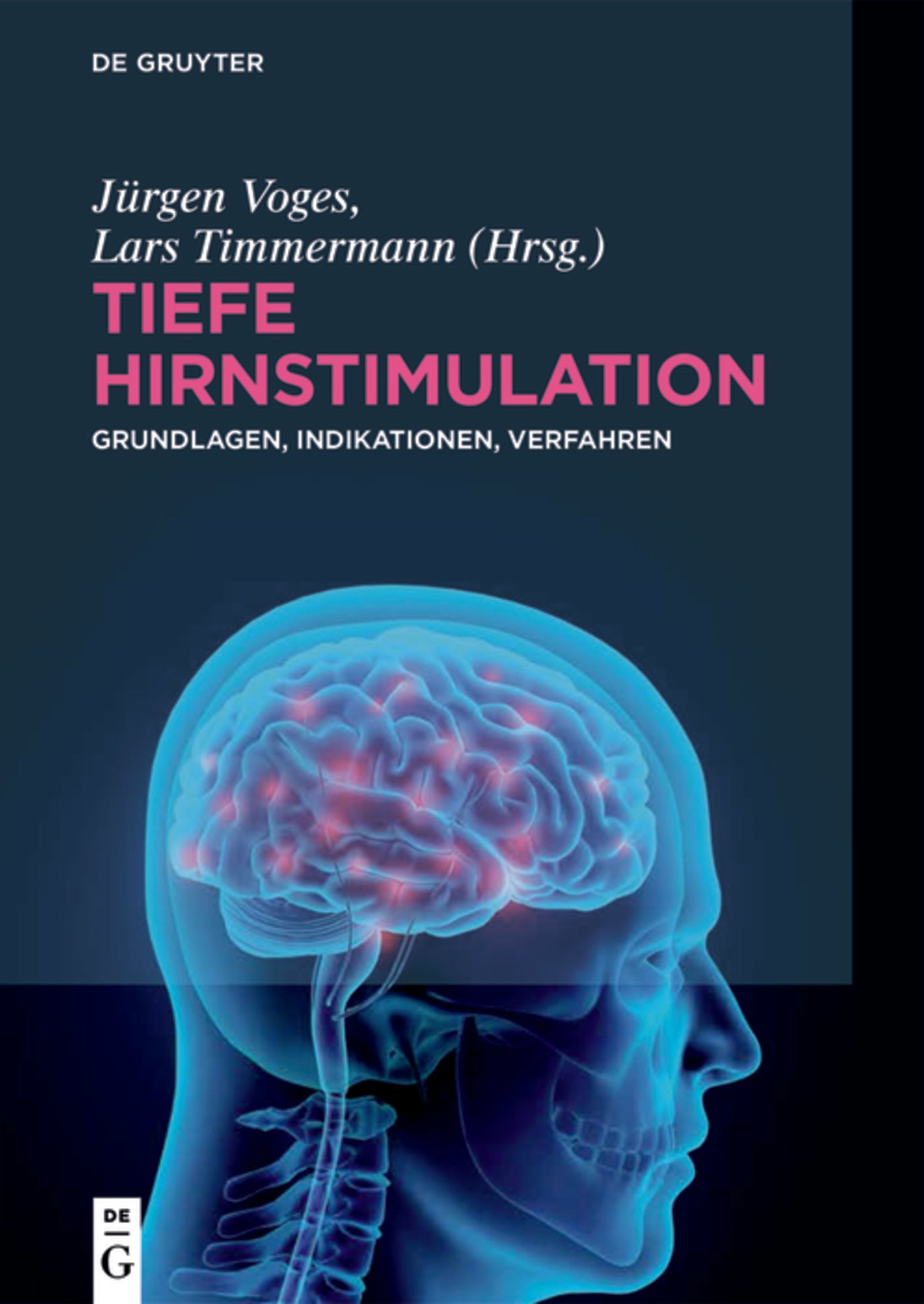 Tiefe Hirnstimulation