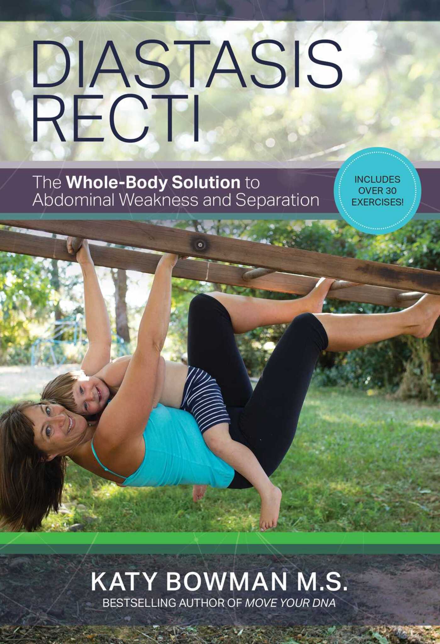 Diastasis Recti