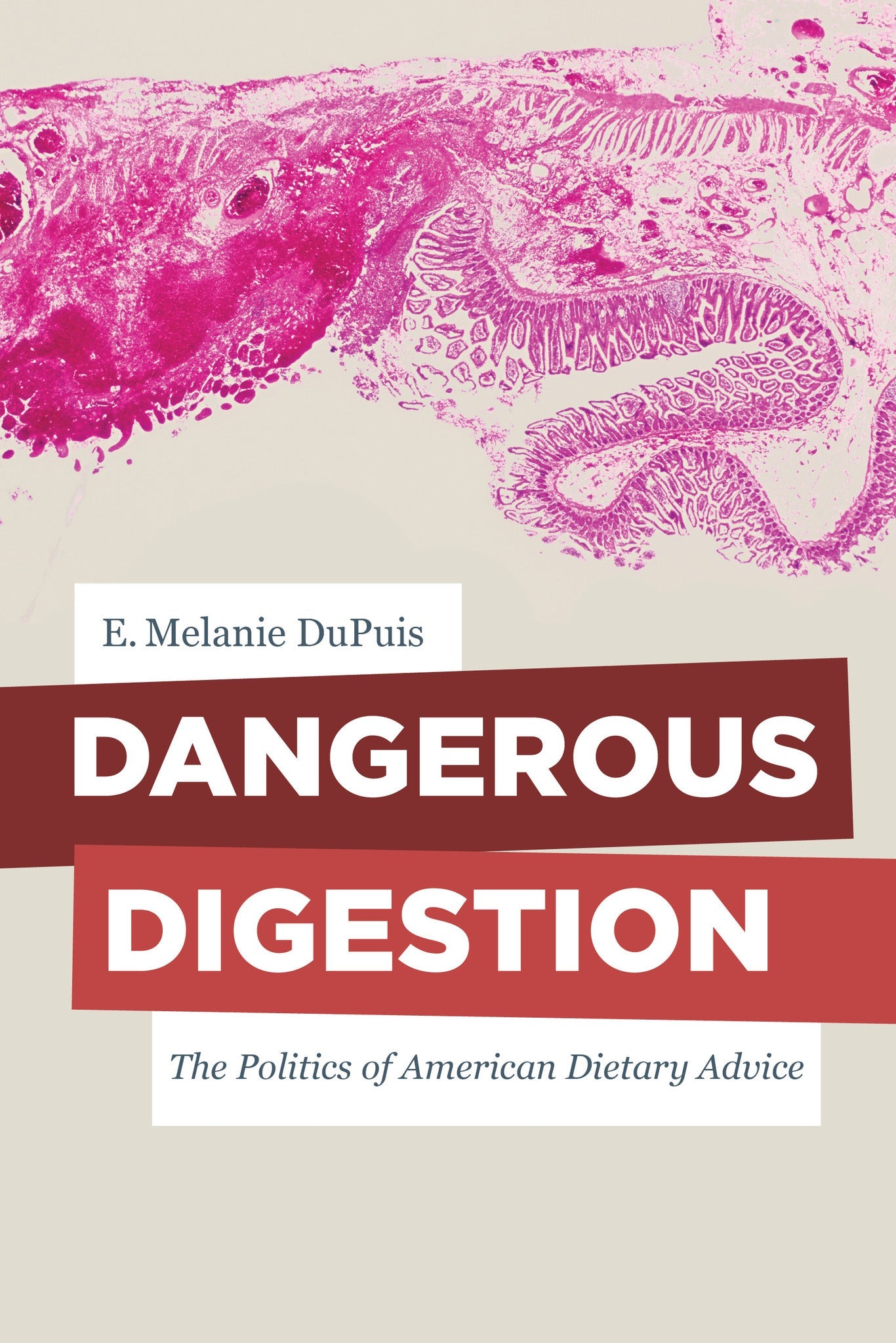 Cover image for Dangerous Digestion ISBN 9780520962132