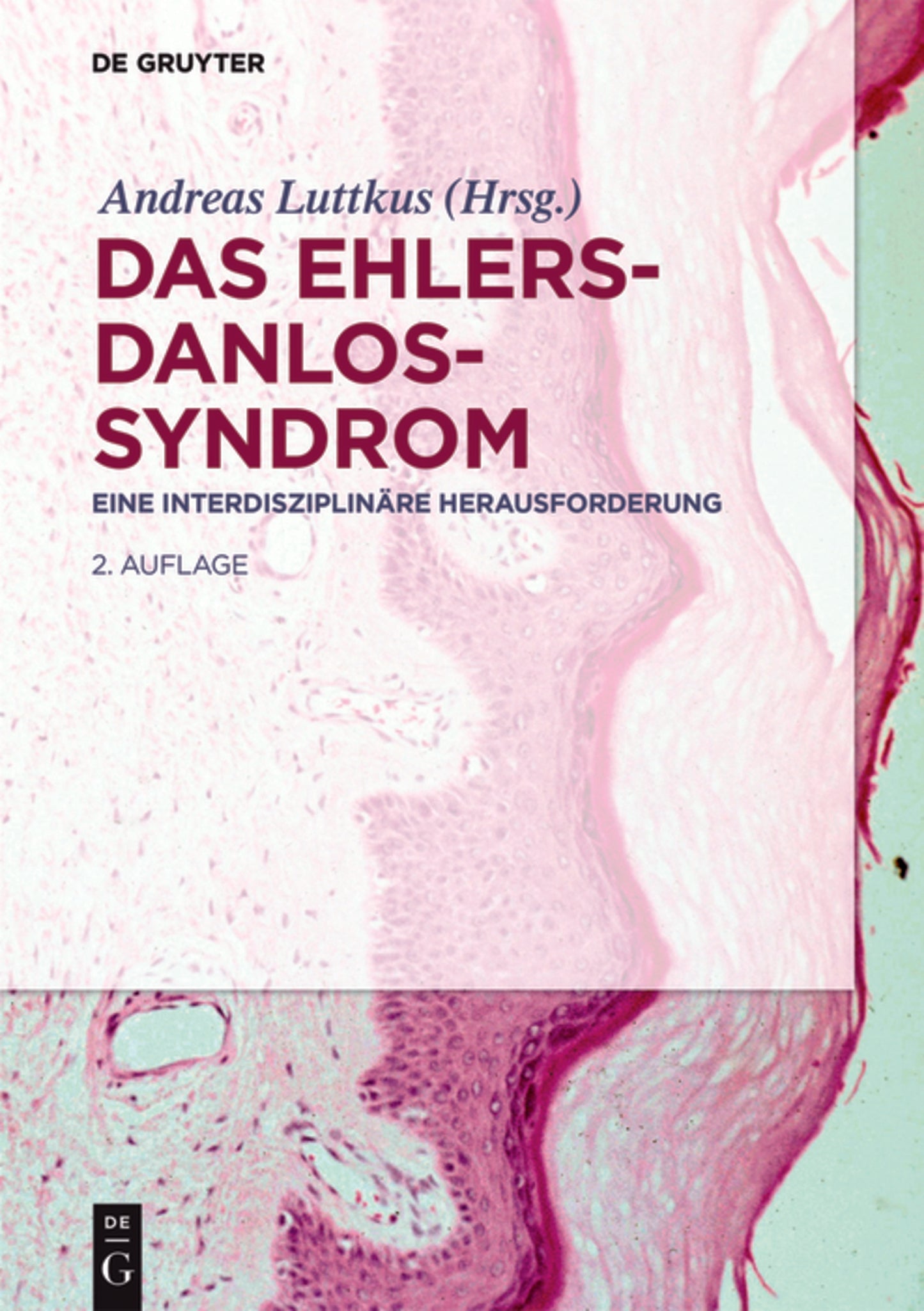 Das Ehlers-Danlos-Syndrom